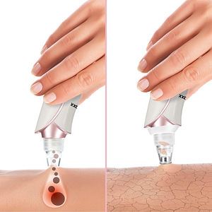 UUS! VITALmaxx Professional 6-in-1 pooride puhastaja (5 foto / 7)