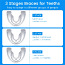 Bruksismivastased hambakaped 3tk komplektis (foto #2)