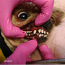 Hambaid ilma anesteesiata (foto #3)