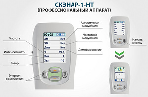 SCENAR-Электронейростимулятор (2 фото из 4)