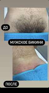 Waxing Tallinn (depilatsioon) (3 foto / 5)