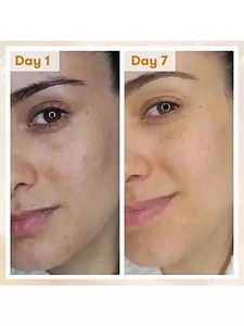 Uus REN pigmendilaike ühtlustav öökreem, 50ml (3 foto / 3)