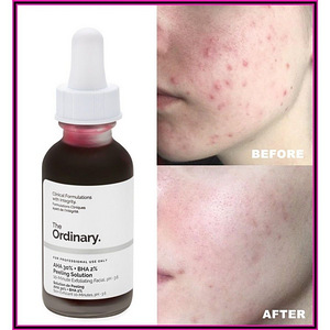 Новый The Ordinary AHA 30% + BHA 2% Peeling Solution 30ml