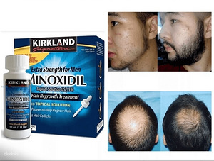 Minoxidil 100% оригинал (2 фото из 2)