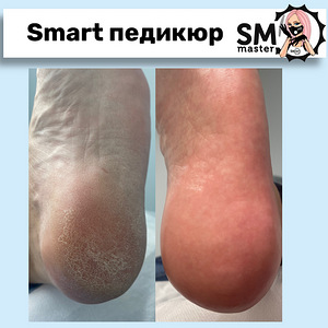 Nutikas pediküür geellakiga (2 foto / 10)